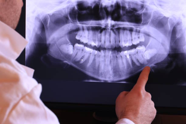 Best Emergency Tooth Extraction in Greensburg, KY