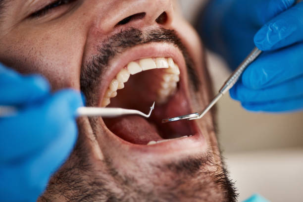 Best Emergency Treatment for Dental Infections or Abscesses in Greensburg, KY
